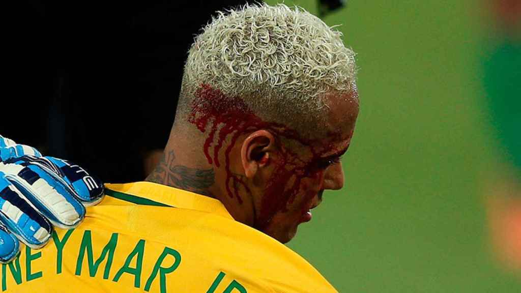 Neymar, herido durante el partido de Brasil ante Bolivia, el 6 de octubre de 2016 | EFE