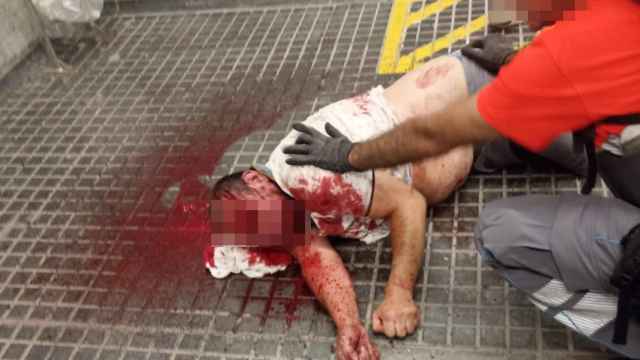 El personal de seguridad privada socorre al herido en una pelea a botellazos en Torre Baró