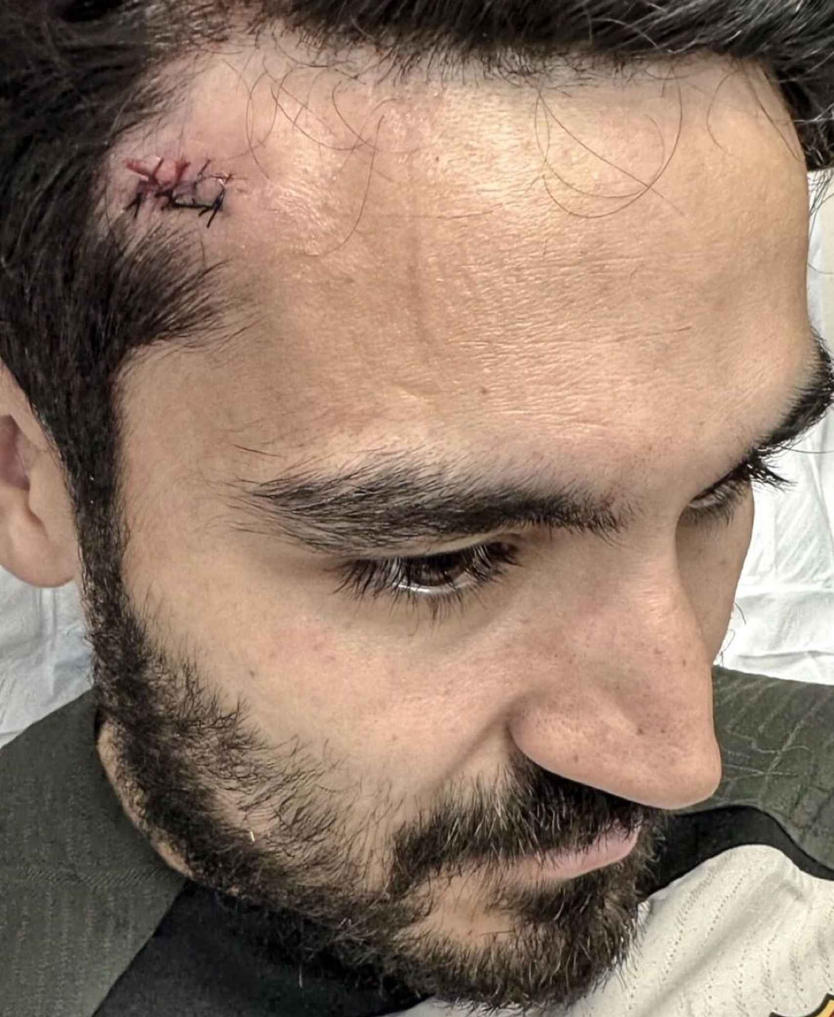 Ilkay Gundogan, con tres puntos de sutura tras sufrir un golpe en la cabeza
