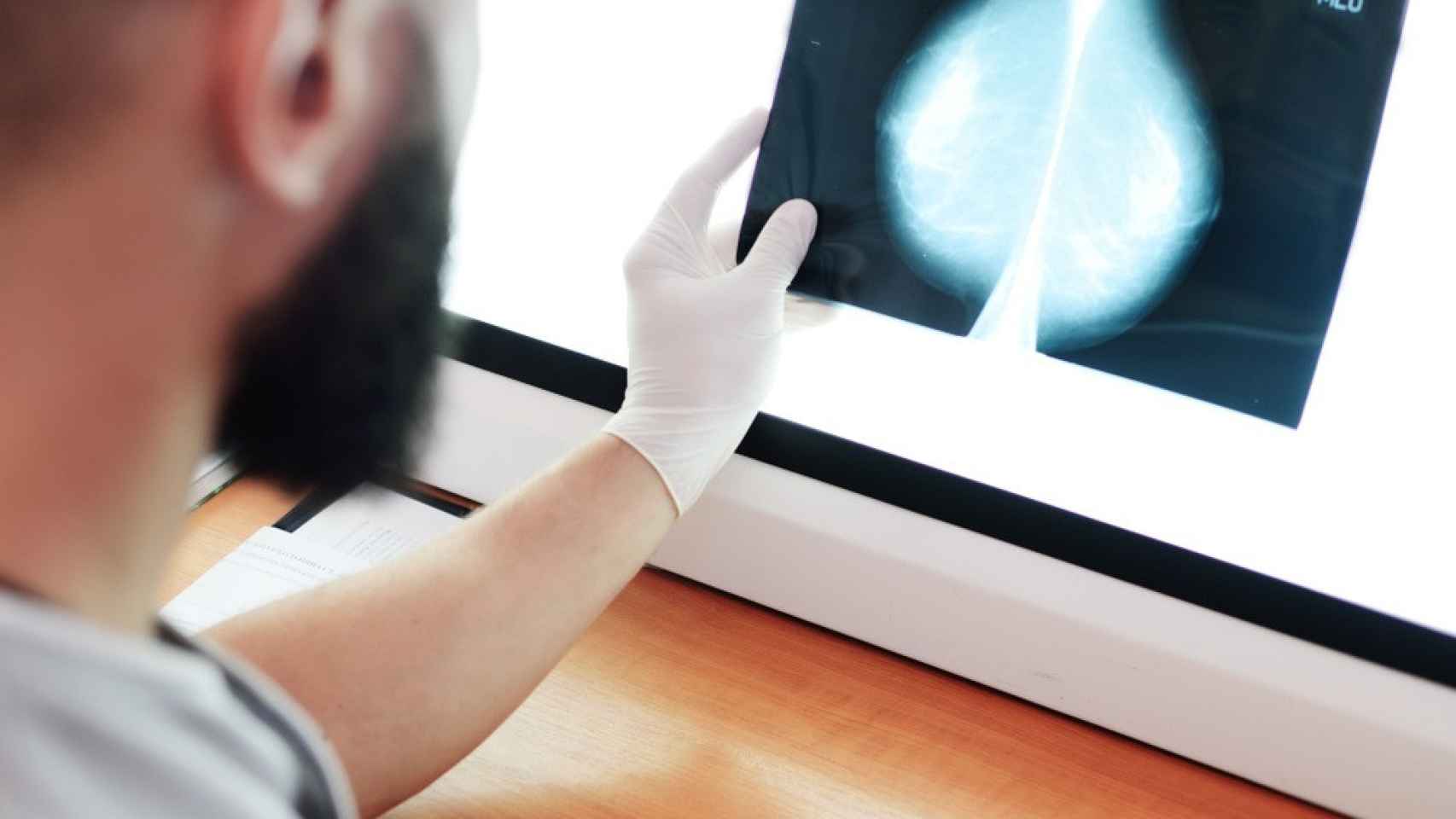 Un experto analizando una mamografía
