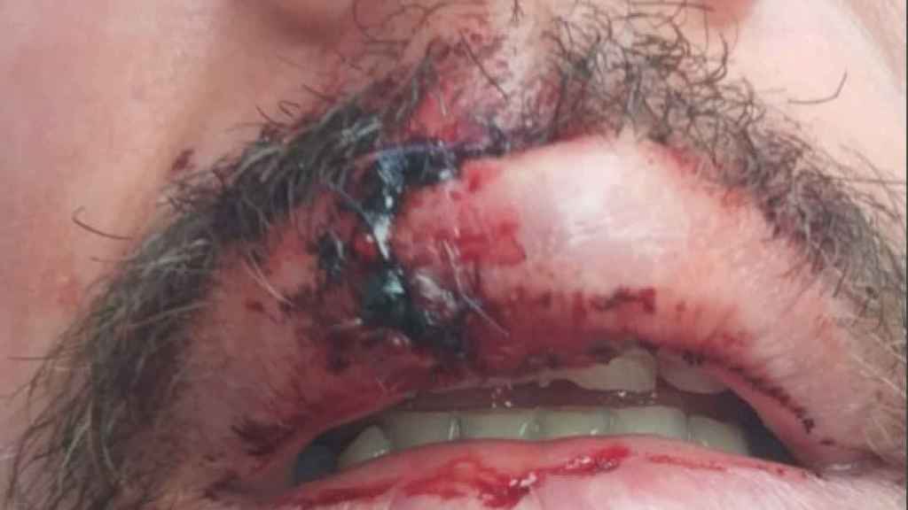 Imagen de un funcionario herido