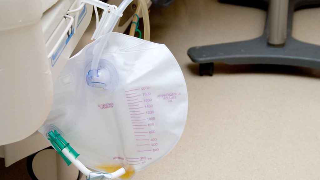 Imagen de una bolsa de orina en un paciente de hospital