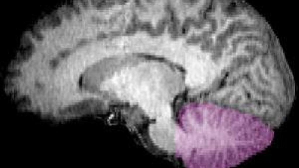 El cerebelo humano, marcado de color morado en la imagen