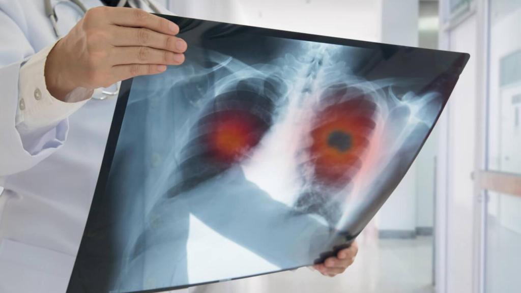 Un médico observa una radiografía de pulmones