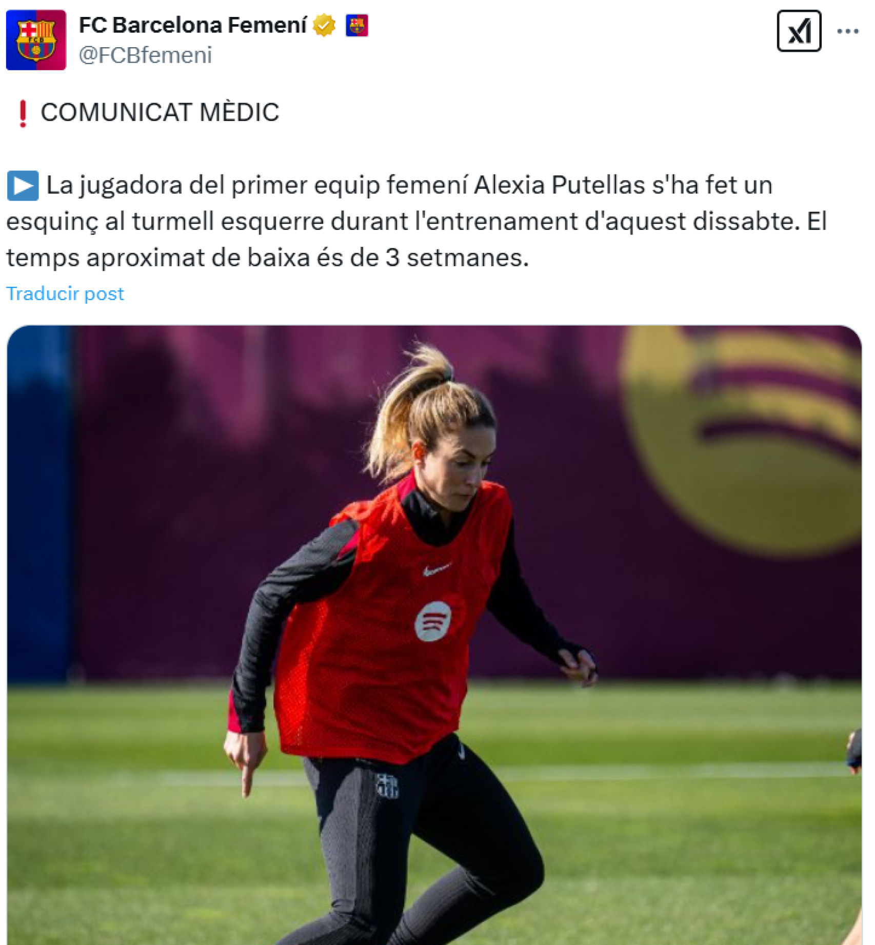 El Barça Femenino comunica la baja de Alexia Putellas por un esguince en el tobillo izquierdo