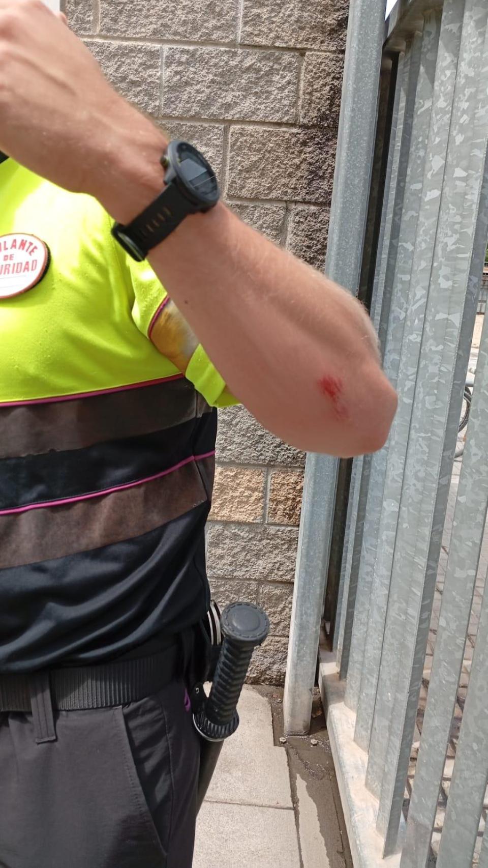 Rasguño en el brazo del vigilante de seguridad que ha reducido a un ladrón en la estación de Blanes
