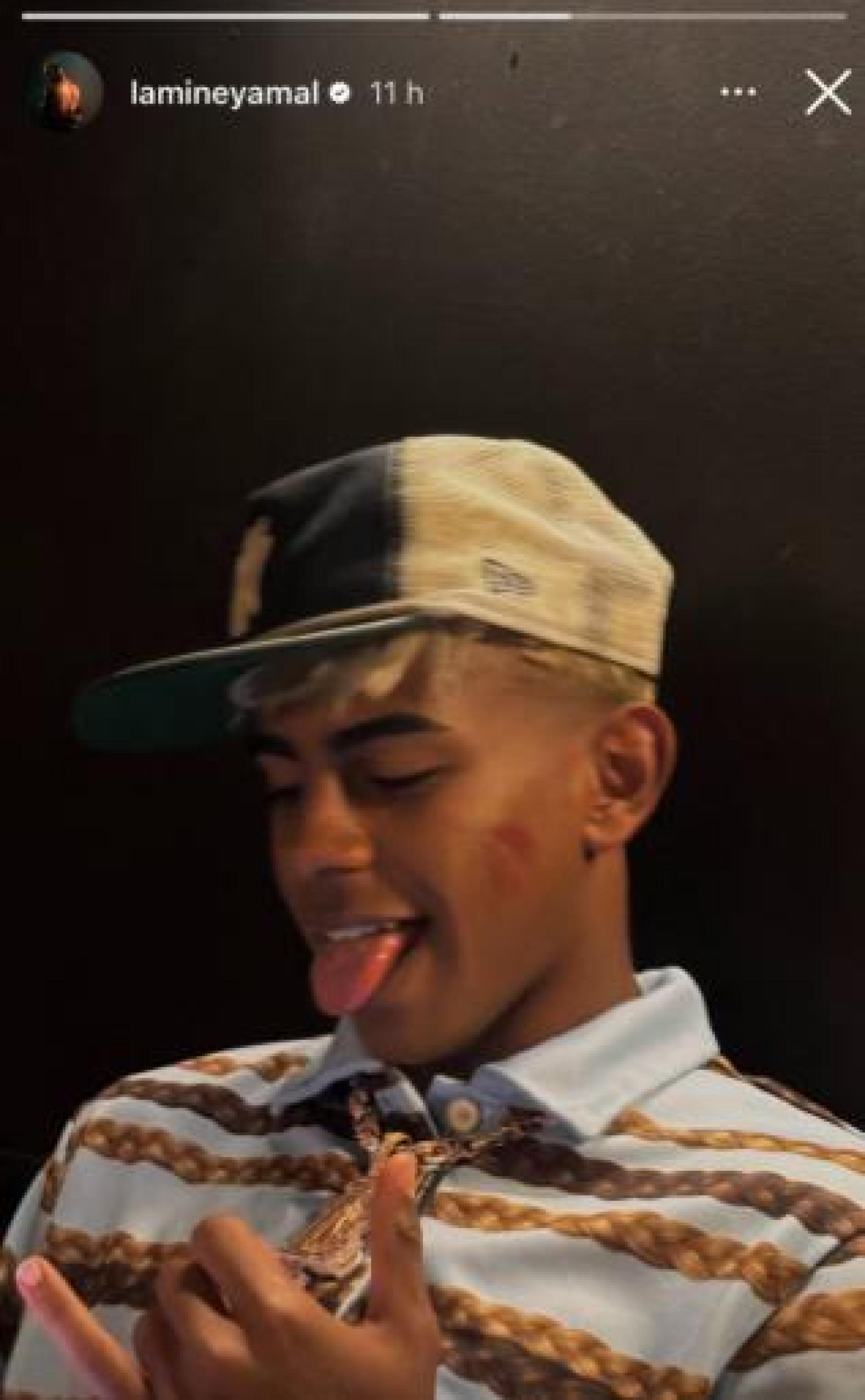 Lamine Yamal publica una historia de Instagram con un beso en la mejilla