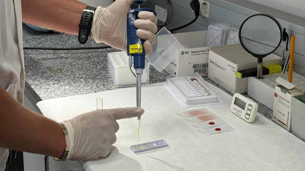 Una muestra de sangre en laboratorio para analizar la posibilidad de que haya la enfermedad infecciosa dengue