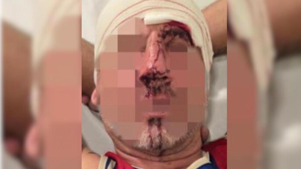 Imagen de la víctima, tras sufrir la primera agresión por parte de los okupas