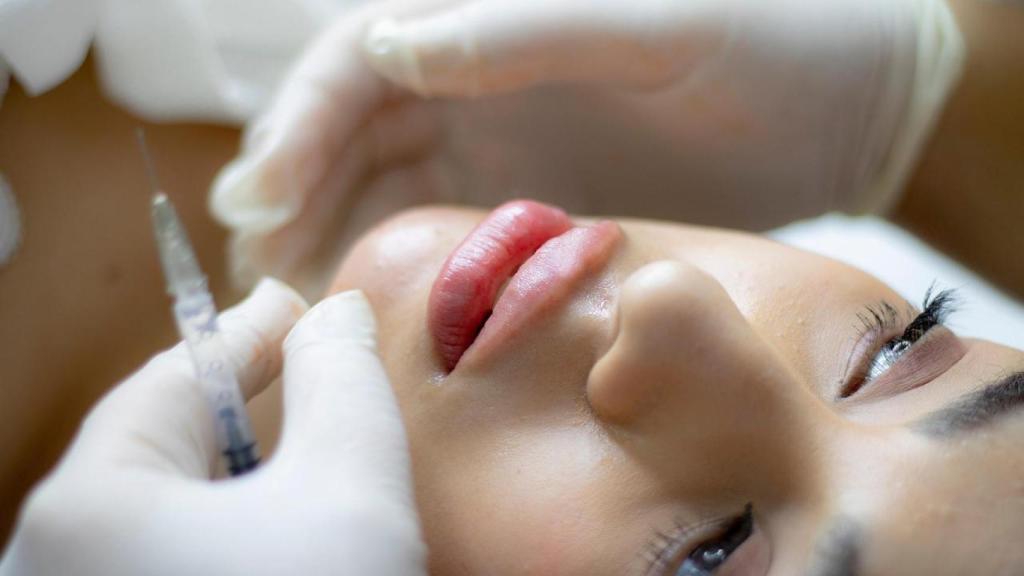Detienen en Bilbao a dos 'médicos' por practicar la técnica “Labios Rusos” ilegalmente