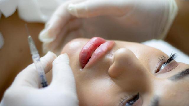Detienen en Bilbao a dos 'médicos' por practicar la técnica “Labios Rusos” ilegalmente