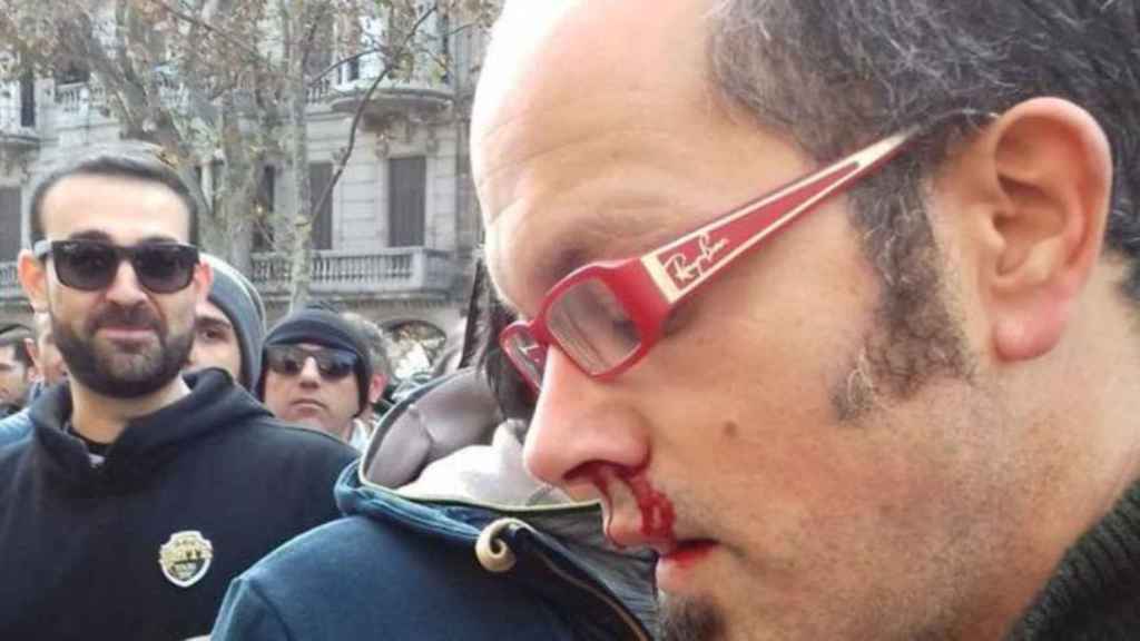 El periodista de El Pais, Alfonso Congostrina, brutalmente agredido por un taxista  / ALBA SÁNCHEZ