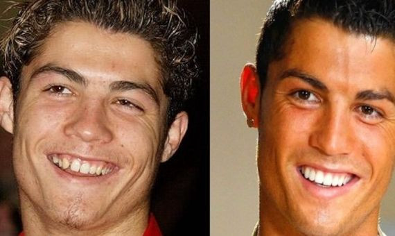 Cristiano Ronaldo antes y después 