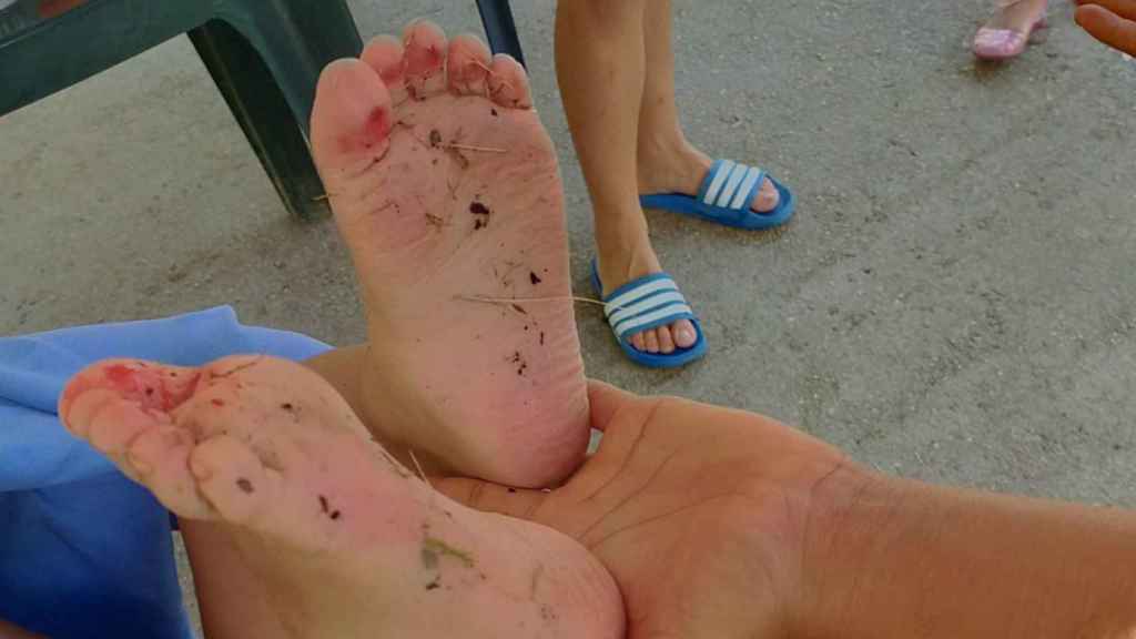 Un niño, con cortes en los pies, tras bañarse en el lago del parque de la Creueta del Coll / BETEVÉ