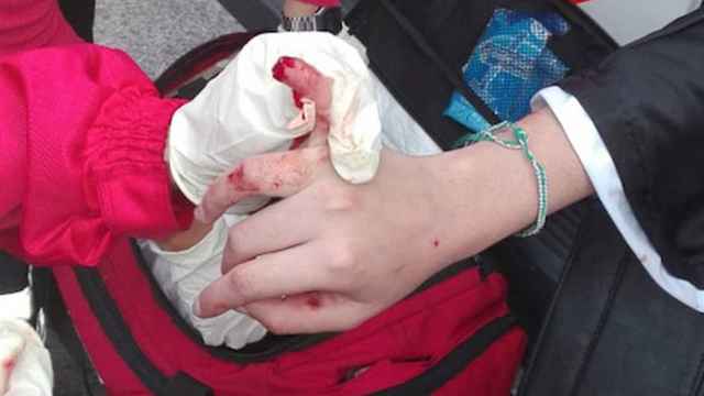 Una persona víctima de un ataca en un dedo en una imagen de archivo