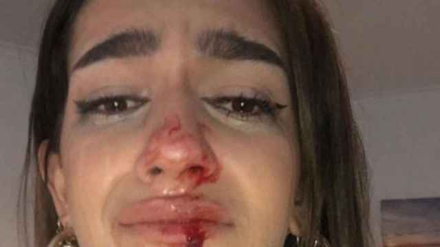 Eva Vildosola, la joven transexual agredida en Barcelona / @EVACASTT