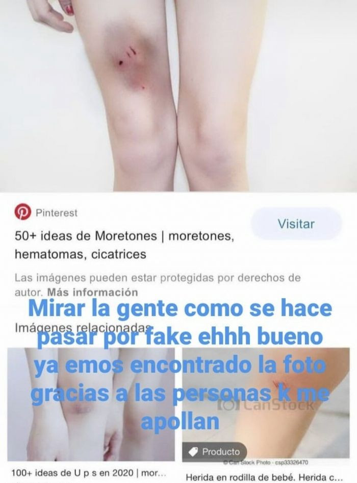 El menor agredido denuncia en Instagram las 'fake news' sobre él / REDES SOCIALES