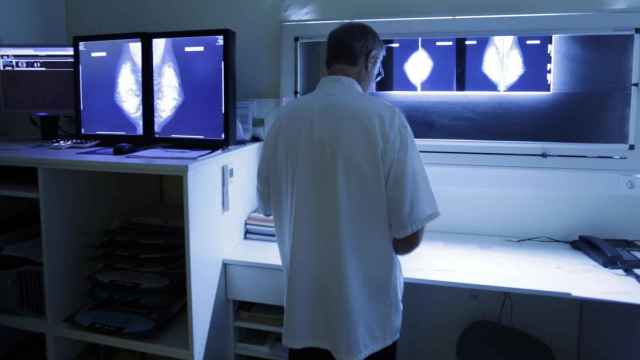 Un radiólogo examina una mamografía en una imagen de archivo