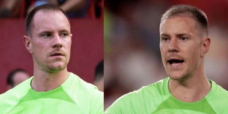 Ter Stegen antes y después de injertarse pelo / METRÓPOLI