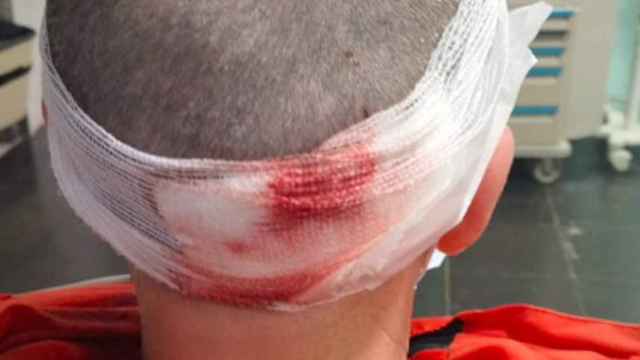 Herido de gravedad por un patinete eléctrico / TWITTER @ACORTESBORRA