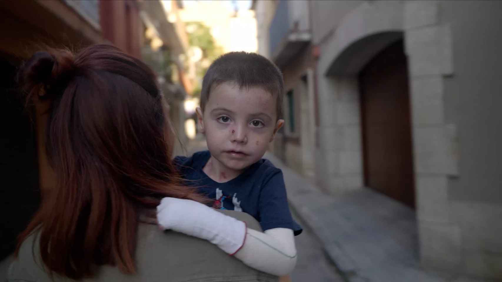 Adrià, que sufre piel de mariposa, y su madre Marta / DEBRA