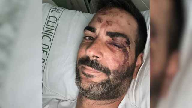 Nacho, el maquinista arrollado por una locomotora de FGC en Barcelona, en el hospital