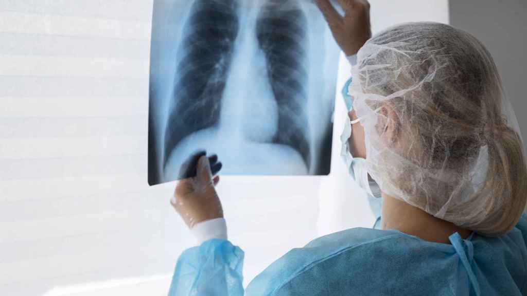 Una especialista examina una radiografía pulmonar
