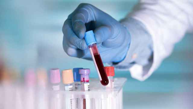 Los niveles de hemoglobina se detectan a través de un simple análisis de sangre