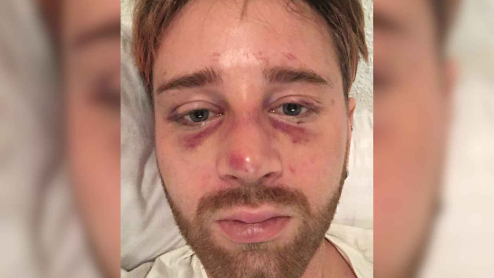 Joseph, herido tras sufrir una agresión homófoba en robo en Barcelona