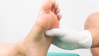 Metatarsalgia: cuando el dolor de pies se convierte en una tortura