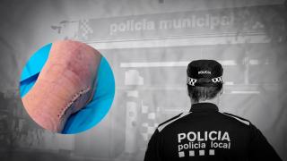 Habla el agente de Terrassa herido en un parking okupado: "Mi agresor está libre y quiere matar a un policía"